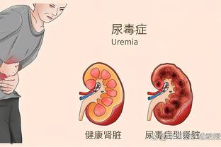 零封奖？！35岁索默本赛季意甲17轮完成12场零封，仅丢7球